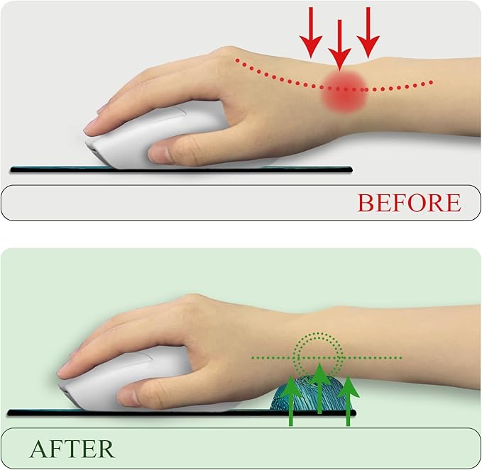 Firefly Forest Mouse Pad with Wrist Rest, Ergonomic Mouse Pad Wrist Support with Non-Slip Pain Relief PU Base, Funny Computer Mousepad, Cute Office Supplies Home Desk Accessories Decor